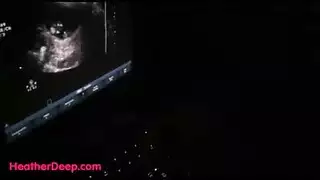 في سن المراهقة يحصل على الوجه قبل أن تكون بصورة عاهرة الوجه